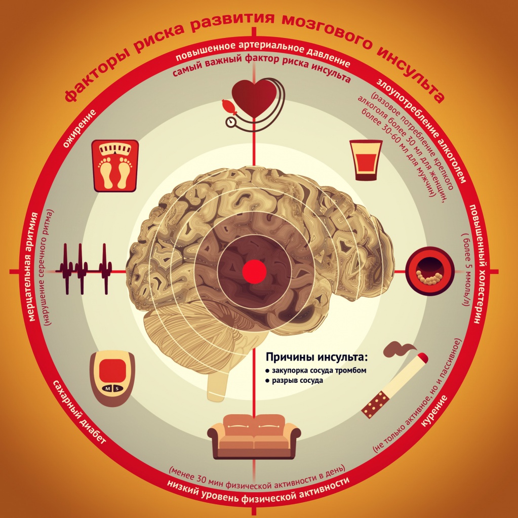 факторы риска инсульта